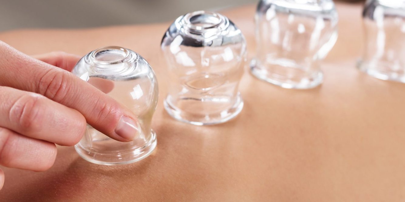 Cupping