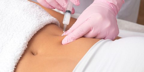 Fat Dissolving Injections